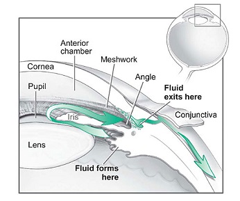 Fluid pathway is shown in teal.